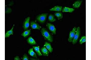 Immunofluorescent analysis of A549 cells using ABIN7168384 at dilution of 1:100 and Alexa Fluor 488-congugated AffiniPure Goat Anti-Rabbit IgG(H+L) (NOB1 anticorps  (AA 103-229))