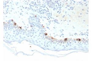 Formalin-fixed, paraffin-embedded human Skin stained with TYRP1-Monospecific Mouse Monoclonal Antibody (TYRP1/3281). (Tyrosinase-Related Protein 1 anticorps  (AA 257-377))