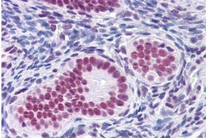 Human Uterus: Formalin-Fixed, Paraffin-Embedded (FFPE)