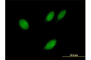 Immunofluorescence of purified MaxPab antibody to TXNL4B on HeLa cell. (TXNL4B anticorps  (AA 1-149))