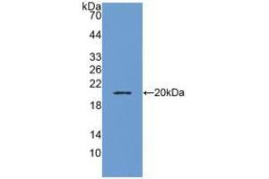 Western blot analysis of recombinant Human ADM. (Adrenomedullin anticorps  (AA 22-147))