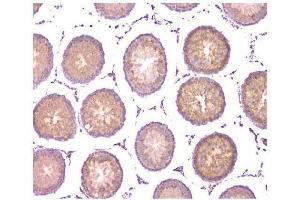 IHC analysis of WWOX using anti-WWOX antibody (ABIN6719627). (WWOX anticorps  (AA 1-245))