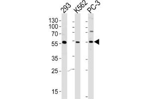 Western Blotting (WB) image for anti-Phosphatidylinositol-4-Phosphate 5-Kinase-Like 1 (PIP5KL1) antibody (ABIN2996126) (PIP5KL1 anticorps)