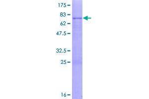 Image no. 1 for Protein-L-Isoaspartate (D-Aspartate) O-Methyltransferase Domain Containing 1 (PCMTD1) (AA 1-357) protein (GST tag) (ABIN1314328)