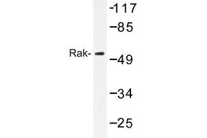Image no. 1 for anti-Fyn-Related Kinase (FRK) antibody (ABIN272190) (FRK anticorps)