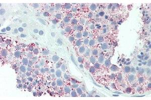 Detection of UCN2 in Human Testis Tissue using Polyclonal Antibody to Urocortin 2 (UCN2) (Urocortin 2 anticorps  (AA 23-107))