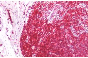 Immunohistochemistry staining of human tonsil (paraffin-embedded sections) with anti-CD45RA (MEM-56), 5 μg/mL.