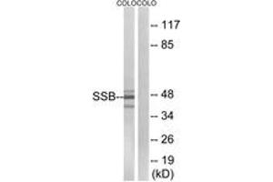 Western blot analysis of extracts from COLO cells, using SSB (Ab-366) Antibody. (SSB anticorps  (AA 341-390))