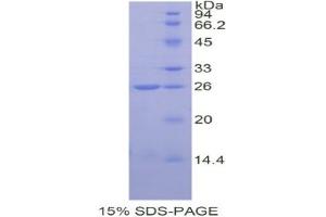 SDS-PAGE analysis of Human COMT Protein.