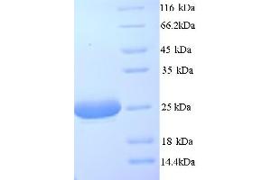 SDS-PAGE (SDS) image for Complement Component 1, Q Subcomponent, A Chain (C1QA) (AA 23-245) protein (His tag) (ABIN5713294)