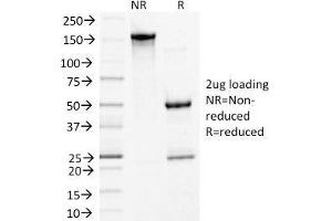 SDS-PAGE Analysis Purified Desmoglein-3 Monoclonal Antibody (5G11).