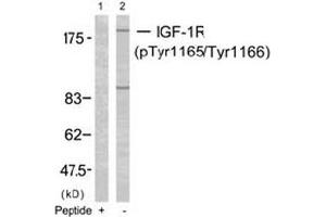Image no. 2 for anti-Insulin-Like Growth Factor 1 Receptor (IGF1R) (pTyr1165), (pTyr1166) antibody (ABIN196774) (IGF1R anticorps  (pTyr1165, pTyr1166))