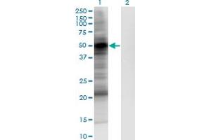 Western Blot analysis of PDPK1 expression in transfected 293T cell line by PDPK1 monoclonal antibody (M05), clone 2E2. (PDPK1 anticorps  (AA 457-556))