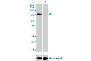 Western Blotting (WB) image for anti-A Kinase (PRKA) Anchor Protein 10 (AKAP10) (AA 1-101) antibody (ABIN599175)