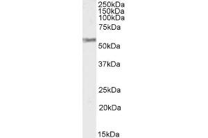 (ABIN570915) (2 μg/mL) staining of Human Adrenal Gland lysate (35 μg protein in RIPA buffer).
