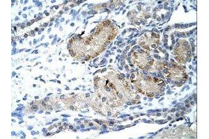 Image no. 1 for anti-General Transcription Factor II I Repeat Domain-Containing 1 (GTF2IRD1) (AA 757-806) antibody (ABIN203342)