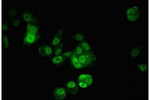 Immunofluorescent analysis of MCF-7 cells using ABIN7147925 at dilution of 1:100 and Alexa Fluor 488-congugated AffiniPure Goat Anti-Rabbit IgG(H+L)