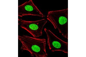 Fluorescent image of Hela cells stained with POLDIP3 Antibody (N-term). (POLDIP3 anticorps  (N-Term))