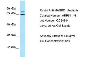 Western Blotting (WB) image for anti-Melanoma Antigen Family D, 1 (MAGED1) (C-Term) antibody (ABIN2789745) (MAGED1 anticorps  (C-Term))