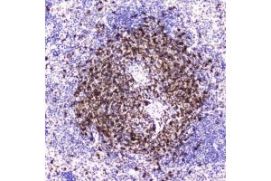 IHC testing of FFPE mouse spleen tissue with CD5 antibody at 2ug/ml. (CD5 anticorps  (AA 25-495))