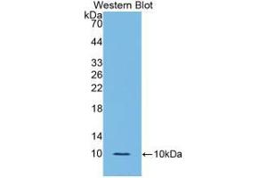 Western blot analysis of the recombinant protein. (IL-6 Receptor anticorps  (AA 385-462))