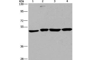 Western Blot analysis of A431, HepG2, Raji and K562 cell using CCR6 Polyclonal Antibody at dilution of 1:966 (CCR6 anticorps)