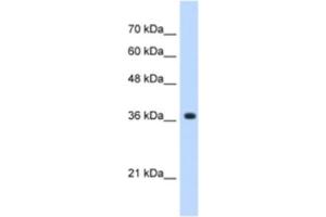 Western Blotting (WB) image for anti-alpha-1,4-N-Acetylglucosaminyltransferase (A4GNT) antibody (ABIN2463051) (A4GNT anticorps)