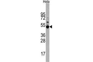 Western blot analysis of MAPKAPK5 Antibody in Hela cell line lysates (35 µg/lane). (MAPKAP Kinase 5 anticorps  (Thr182))