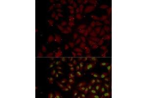 Immunofluorescence analysis of MCF7 cells using CCL25 Polyclonal Antibody (CCL25 anticorps)