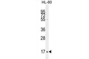 Western Blotting (WB) image for anti-Complement Component 1, Q Subcomponent, C Chain (C1QC) antibody (ABIN2996442)