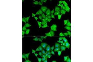 Immunofluorescence analysis of MCF7 cells using ACY1 Polyclonal Antibody (Aminoacylase 1 anticorps)