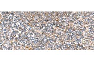 Immunohistochemistry of paraffin-embedded Human tonsil tissue using HLA-DOB Polyclonal Antibody at dilution of 1:40(x200) (HLA-DOB anticorps)