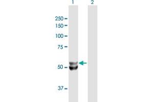 Western Blot analysis of UQCRC1 expression in transfected 293T cell line by UQCRC1 MaxPab polyclonal antibody. (UQCRC1 anticorps  (AA 1-480))