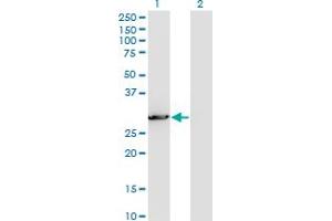 Western Blot analysis of PCSK1N expression in transfected 293T cell line by PCSK1N monoclonal antibody (M02), clone 1E9.