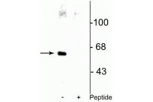 Western blot of HeLa cell lysate showing specific immunolabeling of the ~66 kDa Che-1 protein phosphorylated at Ser477 in the first lane (-).