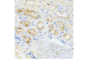 Immunohistochemistry of paraffin-embedded mouse kidney using CCND1 antibody. (Cyclin D1 anticorps  (C-Term))