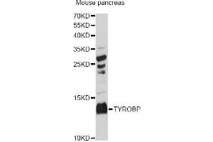 Western blot analysis of extracts of mouse pancreas, using TYROBP Antibody (ABIN5973118) at 1:3000 dilution. (TYROBP anticorps)