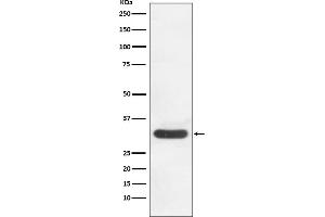 Western blot analysis of CDK4 expression in HeLa cell lysate.