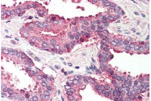 Human Prostate (formalin-fixed, paraffin-embedded) stained with IKBKAP antibody ABIN214497 at 2.