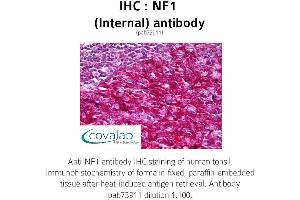 Image no. 1 for anti-Neurofibromin 1 (NF1) (Internal Region) antibody (ABIN1737327)