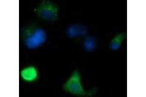Image no. 2 for anti-Melan A (MLANA) antibody (ABIN1499427) (MLANA anticorps)