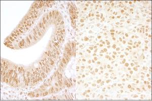 Immunohistochemistry (IHC) image for anti-Casein Kinase 2, beta (CSNK2B) (AA 100-150) antibody (ABIN7454541) (CSNK2B anticorps  (AA 100-150))