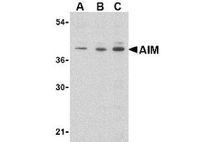Image no. 1 for anti-CD5 Molecule-Like (CD5L) (N-Term) antibody (ABIN265123) (CD5L anticorps  (N-Term))