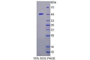 SDS-PAGE analysis of Rat BNIP3 Protein.