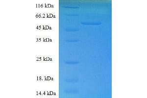 SDS-PAGE (SDS) image for Retinol Dehydrogenase 11 (All-Trans/9-Cis/11-Cis) (RDH11) (AA 22-318), (Cytoplasmic Domain), (Cytosolic) protein (His-SUMO Tag) (ABIN5710231)