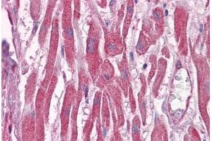 Human Heart: Formalin-Fixed, Paraffin-Embedded (FFPE)