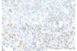 Immunohistochemistry (IHC) image for anti-Forkhead Box Q1 (FOXQ1) (AA 353-403) antibody (ABIN7455177) (Recombinant FOXQ1 anticorps  (AA 353-403))