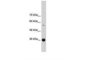 Image no. 3 for anti-Heterogeneous Nuclear Ribonucleoprotein A/B (HNRNPAB) (C-Term) antibody (ABIN203059) (HNRNPAB anticorps  (C-Term))