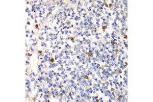 Immunohistochemistry of paraffin-embedded mouse spleen using PSMD7 antibody (ABIN1876544) at dilution of 1:100 (40x lens). (PSMD7 anticorps)