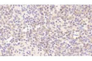 Detection of CHRNa4 in Human Spleen Tissue using Polyclonal Antibody to Cholinergic Receptor, Nicotinic, Alpha 4 (CHRNa4)
